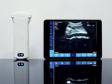 Wireless Ultrasound Scanner | SonoStar